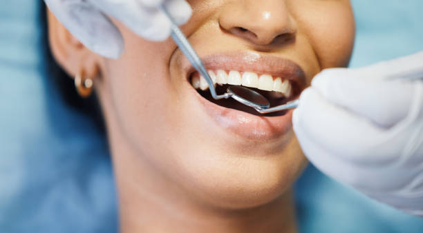 Best Emergency Root Canal Therapy in Hidalgo, TX